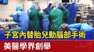 子宮內替胎兒動腦部手術 美醫學界創舉