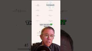 Understanding Normally Closed and Normally Open Push Buttons in Electronic Circuits