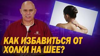 Как убрать вдовий горбик? Упражнения и массаж от холки на шее. Профилактика плохого кровообращения