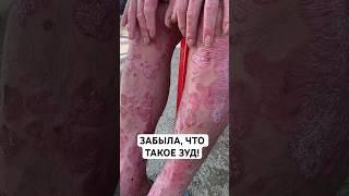 Кожа шелушится, зуд не даёт покоя? Я нашла то, что действительно помогает.