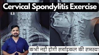 Exercises for cervical spondylitis | Cervical spondylosis exercise in hindi | gardan ki exercise