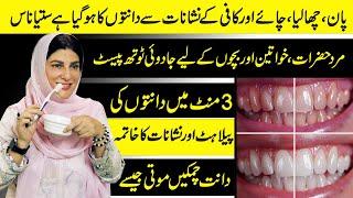 Turn Dirty Yellow Teeth to Pearl White in Just 3 Minutes | Plaque & Tartar Removal