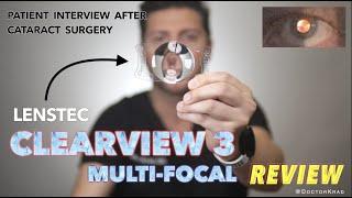 Lenstec CLEARVIEW 3 MultiFocal IOL Review | Cataract Surgery | Real Patient Feedback | No glasses!