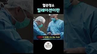 혈관 청소 킬레이션이란