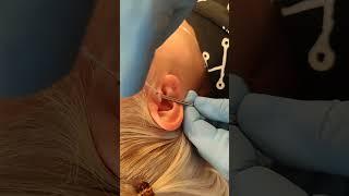 #TragusPiercing using #Jewellery by #BVLA by Jabba  @get-pierced Carlisle, Cumbria #piercing