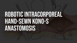 Robotic Handsewn Kono-S Anastomosis