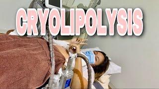 PAANO PUMAYAT NG MABILIS? | CRYOLIPOLYSIS | Freezing fat cells