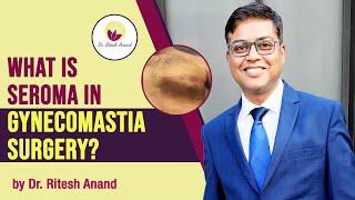 Seroma Formation After Gynecomastia Surgery - It's Treatment & Prevention | Dr Ritesh Anand