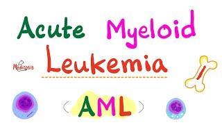 Acute Myeloid Leukemia (AML) - Auer Rods - Myeloperoxidase Positive - Hematology & Oncology Series