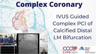 IVUS Guided Complex PCI of Calcified Distal LM Bifurcation