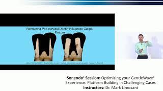 Optimizing Your GentleWave® Experience: Platform Building in Challenging Cases - Dr. Mark Limosani