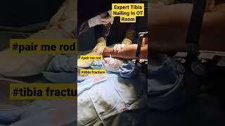 Expert Tibia Nailing | #tibiafracture #tibia #bonefracture #bonepain  #bonesurgery #doctorslife #acl