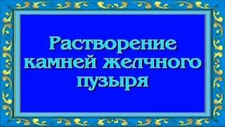 Растворение камней в желчном пузыре ▪️ Dissolution of gallstones