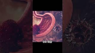 걸리면 무서운 암 순위 TOP10