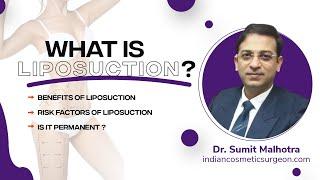 What Is Liposuction | Liposuction Uses , Benefits & Risk | Dr. Sumit Malhotra