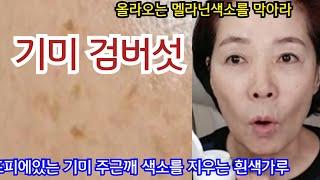 겉기미 주근깨 색소 검버섯을싹지워라/기미스킨/지혈제로 기미미백스킨만들기/트라넥삼산미백효소스킨