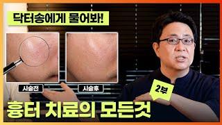 흉터 치료의 모든 것 2부/흉터치료 하는 시기/흉터예방법/상처난후 관리방법