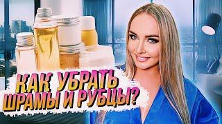 Как ИЗБАВИТЬСЯ от ШРАМОВ и РУБЦОВ? РЕКОМЕНДАЦИИ врача-косметолога.