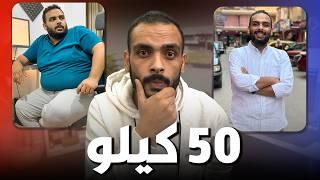 خسيت ٥٠ كيلو في ٦ شهور | مالايخبرونك به عن عمليات السمنة ( تكميم المعدة وتحويل المسار )️