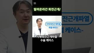 접히면서 말려들어간 어깨 힘줄파열 수술