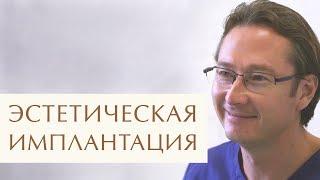  Этапы и виды имплантации передних зубов. Этапы имплантации зубов. 12+