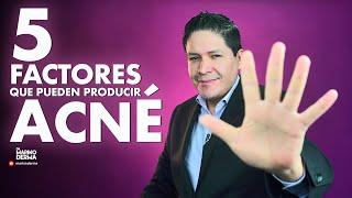 5 FACTORES QUE PRODUCEN ACNE || DR MARINO DERMATOLOGO