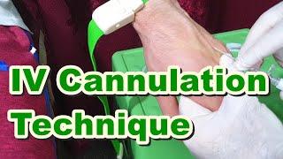 How to Insert IV Cannula | IV Cannulation Technique | Branula | Intravenous Catheter