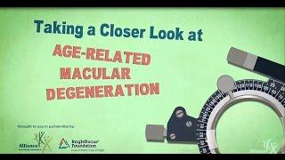 Taking a Closer Look at Age-Related Macular Degeneration