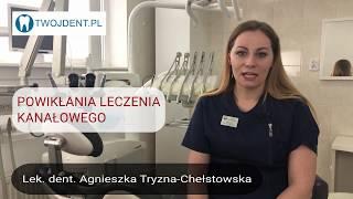 Powikłania leczenia kanałowego Twój Dentysta Grójec