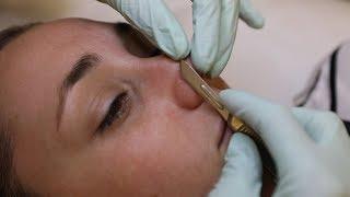 Dermaplaning facial resets your face with scalpels and acid | Glam Lab