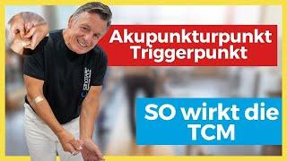 Akupunktur und Triggerpunkte – so wirkt TCM! 