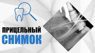 Прицельный снимок в стоматологии.