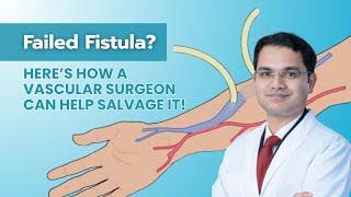 Failed Fistula? Here’s How a Vascular Surgeon Can Help Salvage It! | Dr Rahul Agarwal | Vascularhyd