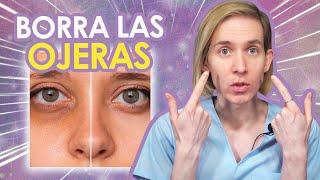 COMO BORRAR las OJERAS - Guía para eliminarlas - Fácil y seguro - Simon Scarano