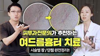 나에게 맞는, 여드름 흉터 치료 고르는 방법 (feat. 프락셀 레이저, 도트필링, 서브시전 시술로 없애는 법)