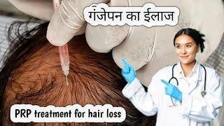 Does PRP stop hair fall | (platelet rich plasma) treatment for hair loss |