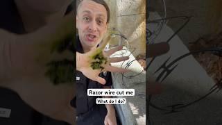 Hand sliced open by razor wire? Try this… #survival #health #medical