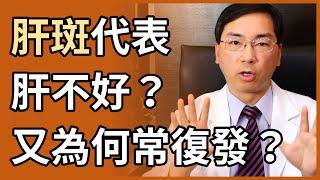 肝斑、黑斑代表肝不好嗎？為什麼剛治療完有效，但很快就復發呢？有永遠不復發的方法嗎？