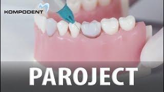 PAROJECT Kompodent