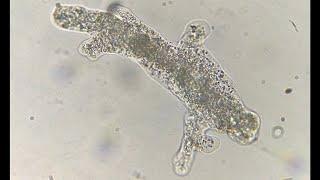 Amoeba movement with pseudopodia under a microscope