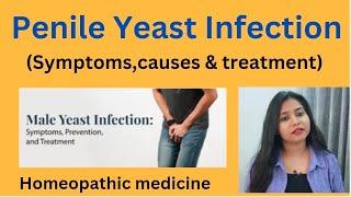 Penile yeast infection treatment !! Penile fungal infection symptoms,causes & homeopathic medicines