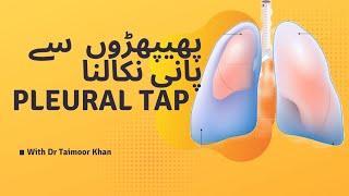 Pleural tap explained in Urdu by Emergency Physician. پھپھڑوں سے پانی کیسے نکالتے ہیں ؟