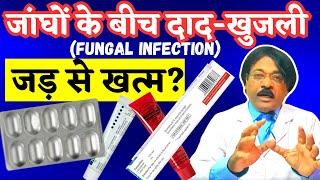 जांघों के बीच फंगल संक्रमण | जांघों के बीच दाद-खुजली (JOCK ITCH) | skin [fungal] infection treatment