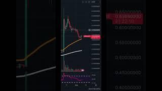 XRP Correction Is Over, Watch To See The Reasons Why...