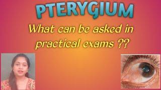 PTERYGIUM || Practicals for undergraduates|| Psuedopterygium|| Probe test || conjunctival autograft