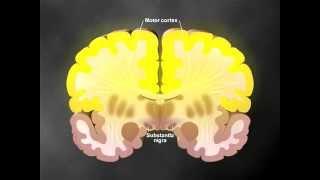 Parkinson's part 2 of 2 - Medical Animation by Watermark