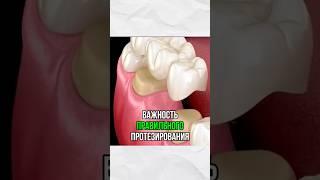 Лечение на имплантах в 3 раза ДОРОЖЕ лечения на своих зубах #зубныеимпланты