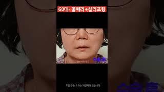 60대 울쎄라,실리프팅 한달차 변화 #리프팅 #팔자주름 #실리프팅 #울쎄라 #ultherapy #threadlift #모즈클리닉 *모든 시술/수술은 부작용이 있을 수 있습니다