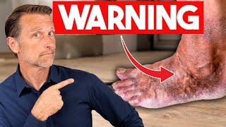 Use Your Feet As Warning Signs