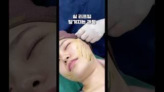 실 리프팅 당겨지는 과정 #실리프팅